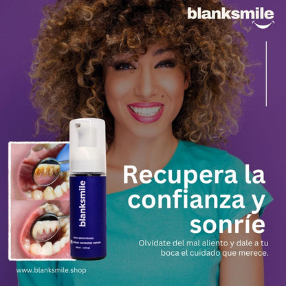 Blanqueador dental V34 blanksmile™