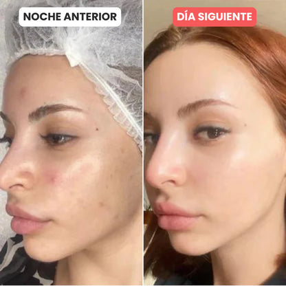 Nuvella™ Mascarilla de Biocolágeno