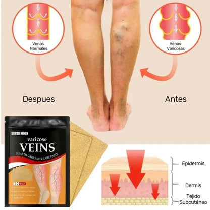 Parches Para Varices - VeinsFix 💜 ¡EFECTO INMEDIATO! 12 PARCHES